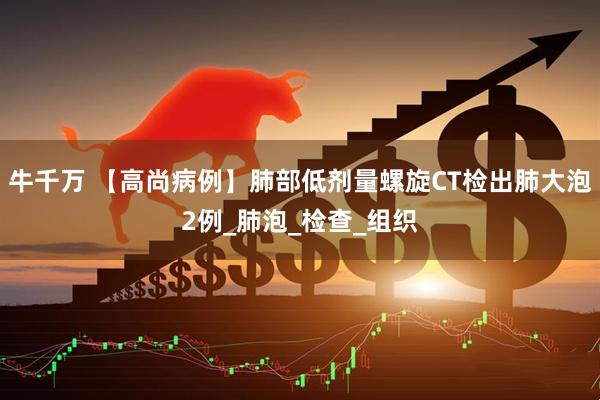 牛千万 【高尚病例】肺部低剂量螺旋CT检出肺大泡2例_肺泡_检查_组织